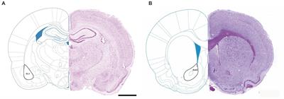 The long-term effects of maternal deprivation on the number and size of inhibitory interneurons in the rat amygdala and nucleus accumbens